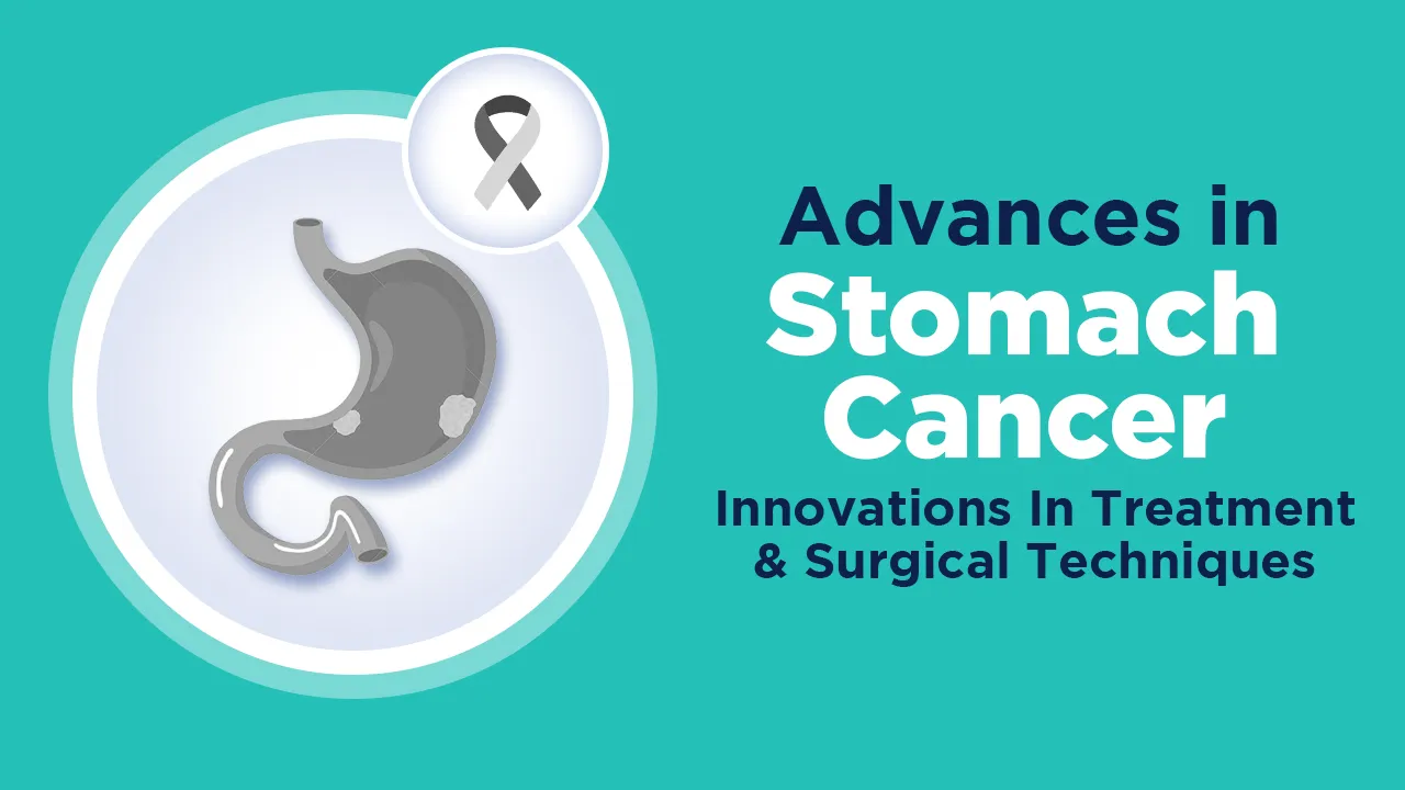 Advances In Stomach Cancer Innovations In Treatment And Surgical Techniques