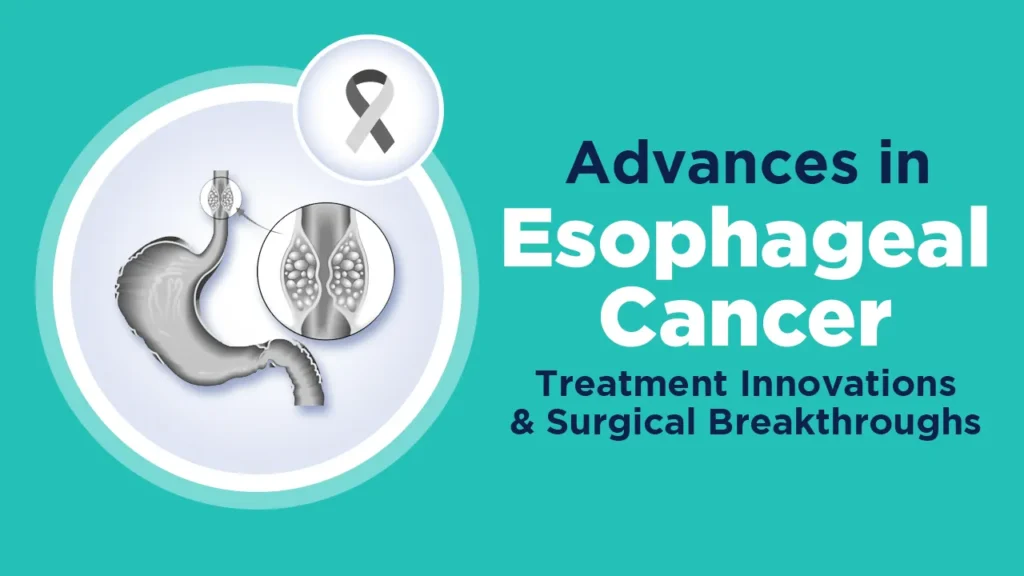 Advances in Esophageal Cancer Treatment Innovations and Surgical Breakthroughs