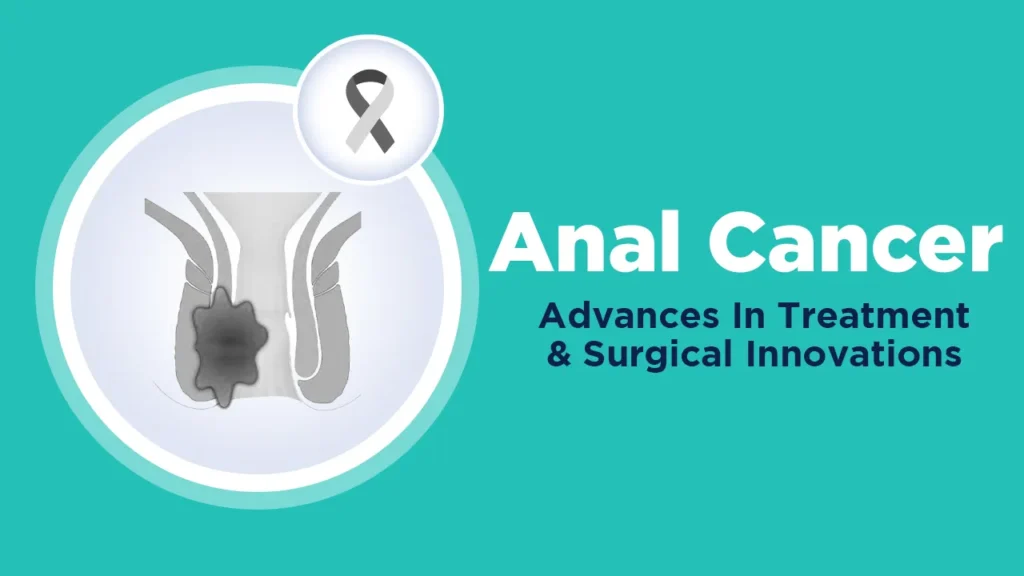 Anal Cancer Advances in Treatment and Surgical Innovations
