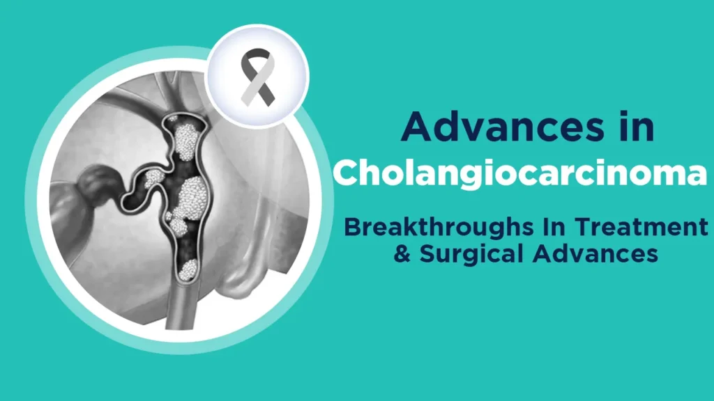 Cholangiocarcinoma Breakthroughs in Treatment and Surgical Advances