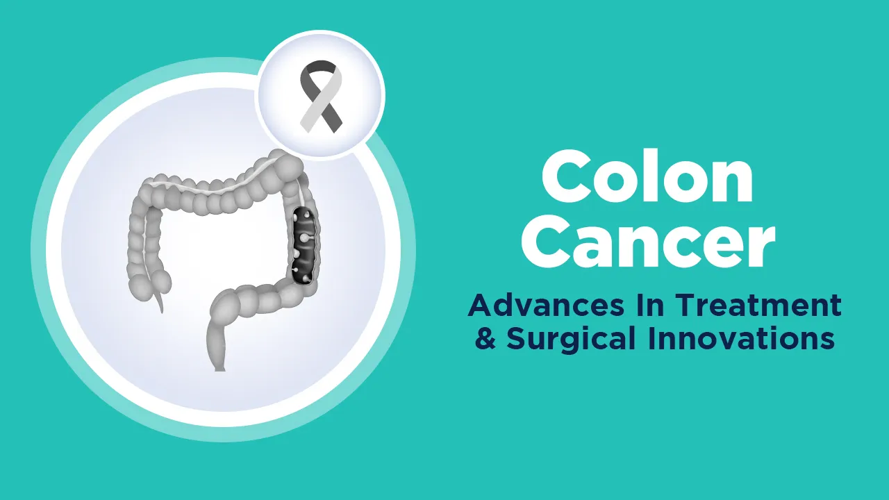 Colon Cancer Advances in Treatment and Surgical Innovations