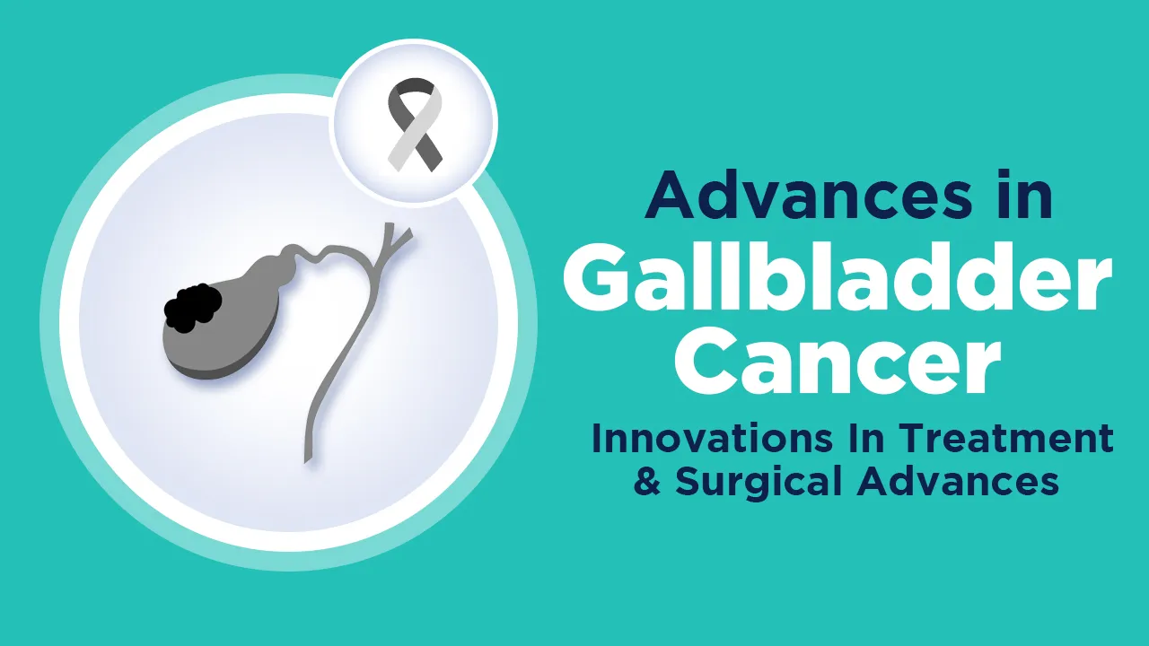 Gallbladder Cancer Innovations in Treatment and Surgical Advances