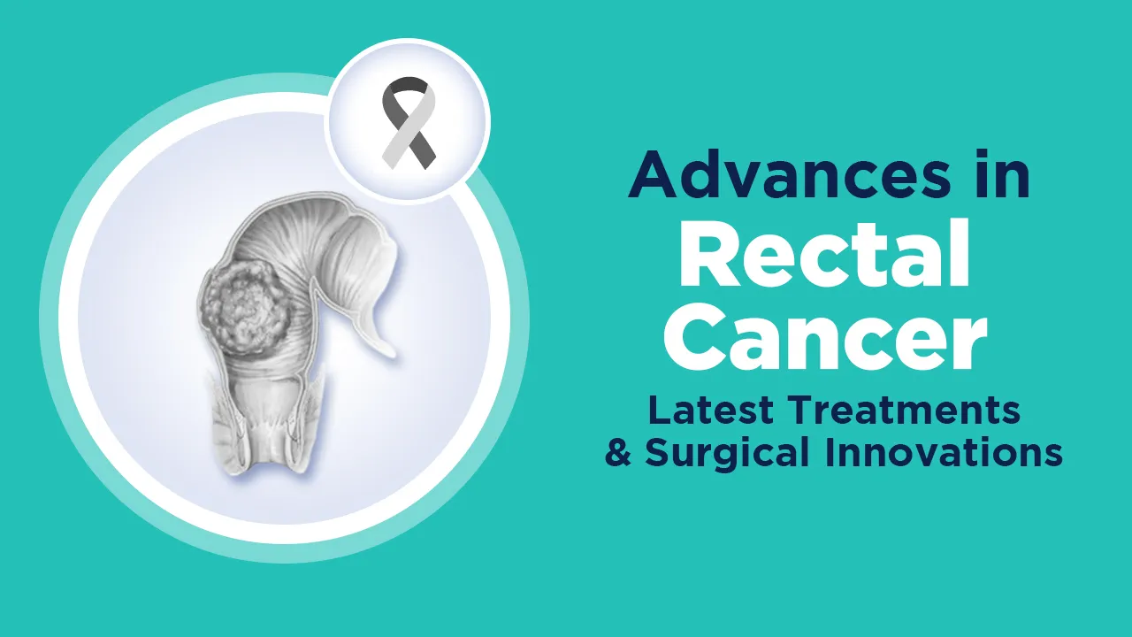 Rectal Cancer Latest Treatments and Surgical Innovations
