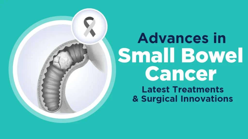 Small Bowel Cancer Latest Treatments and Surgical Innovations