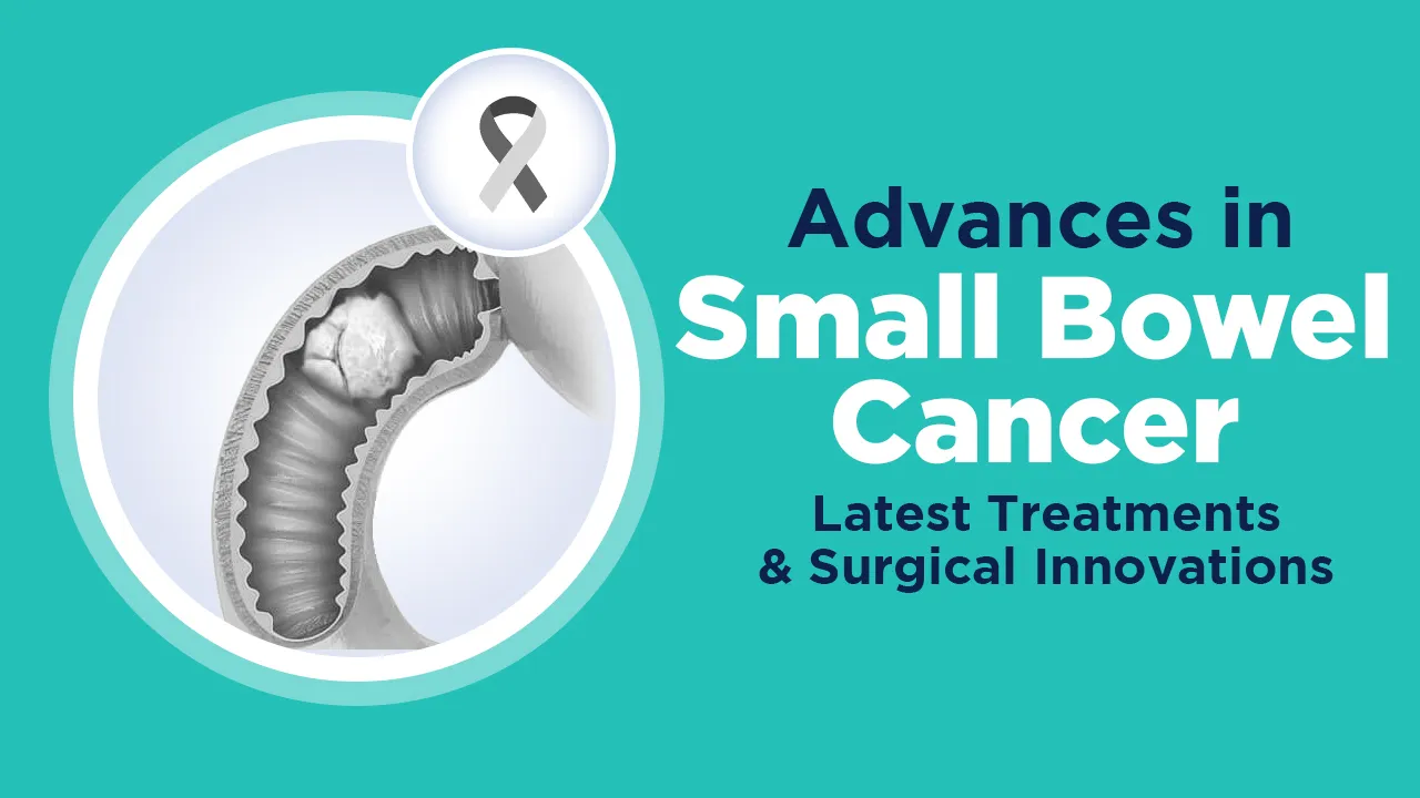 Small Bowel Cancer Latest Treatments and Surgical Innovations