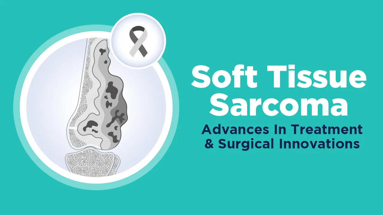Soft Tissue Sarcoma Advances in Treatment and Surgical Innovations