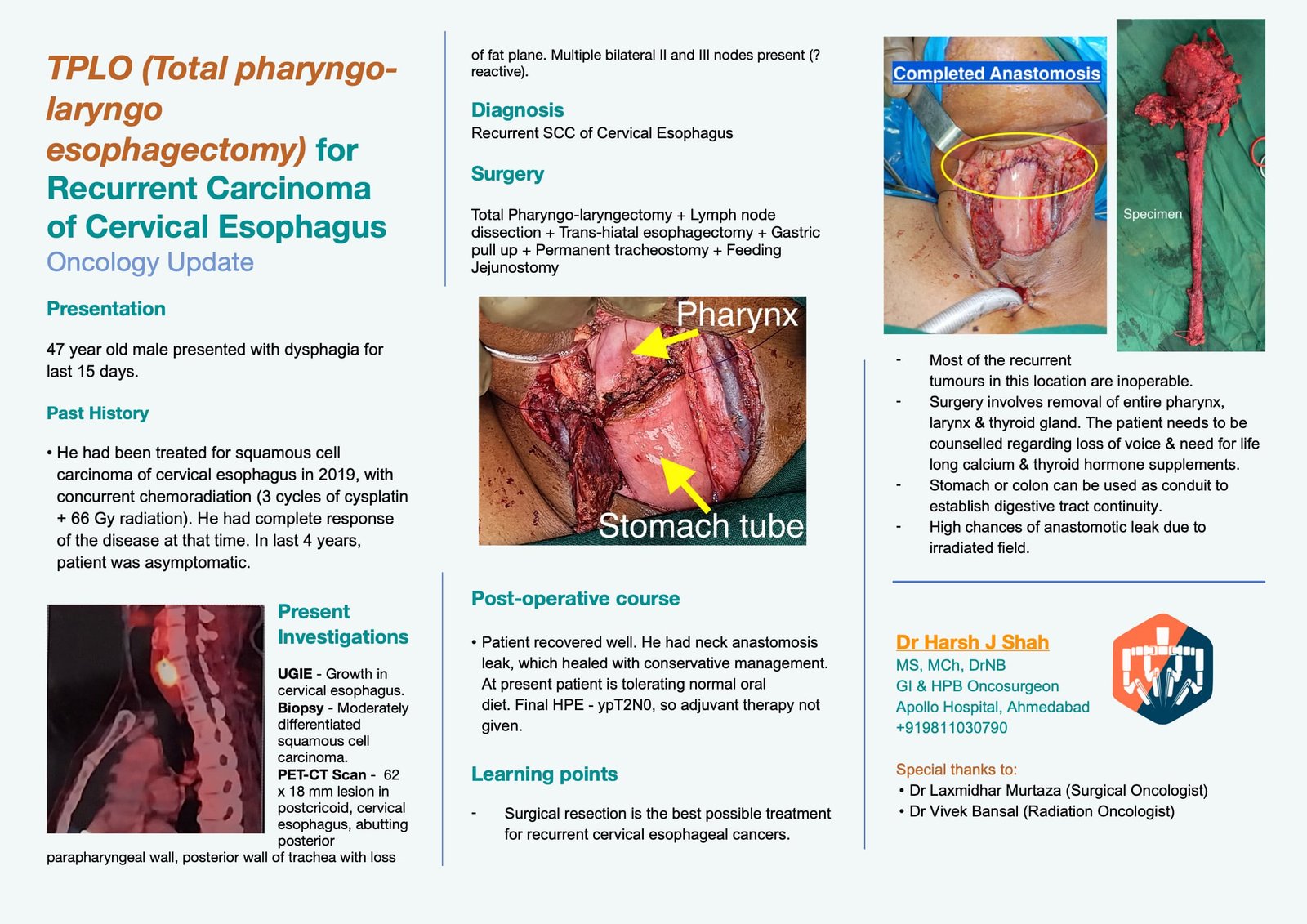 TPLO Total pharyngo laryngo esophagectomy for Recurrent Carcinoma of Cervical Esophagus