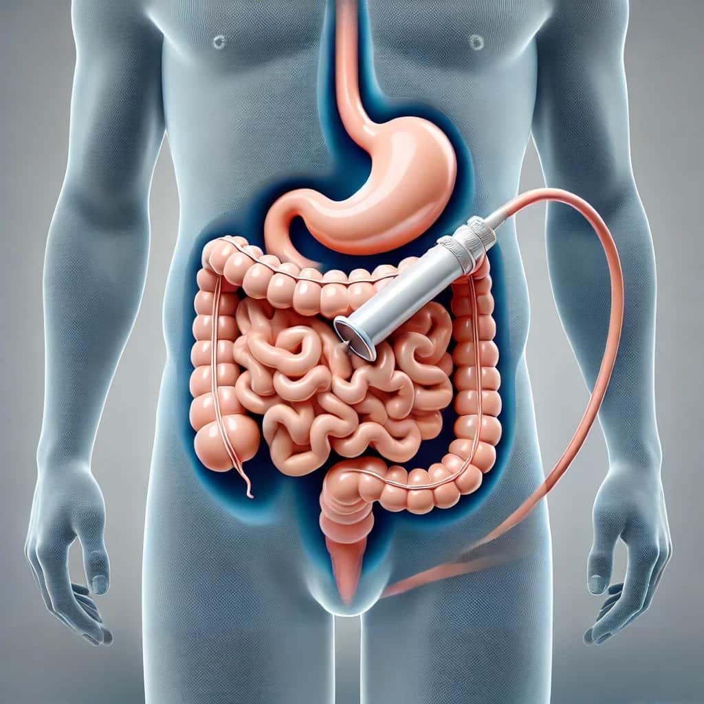 Advancements in Hyperthermic Pressurized Intraperitoneal Aerosol Chemotherapy HPIPAC for Gastric Cancer Treatment