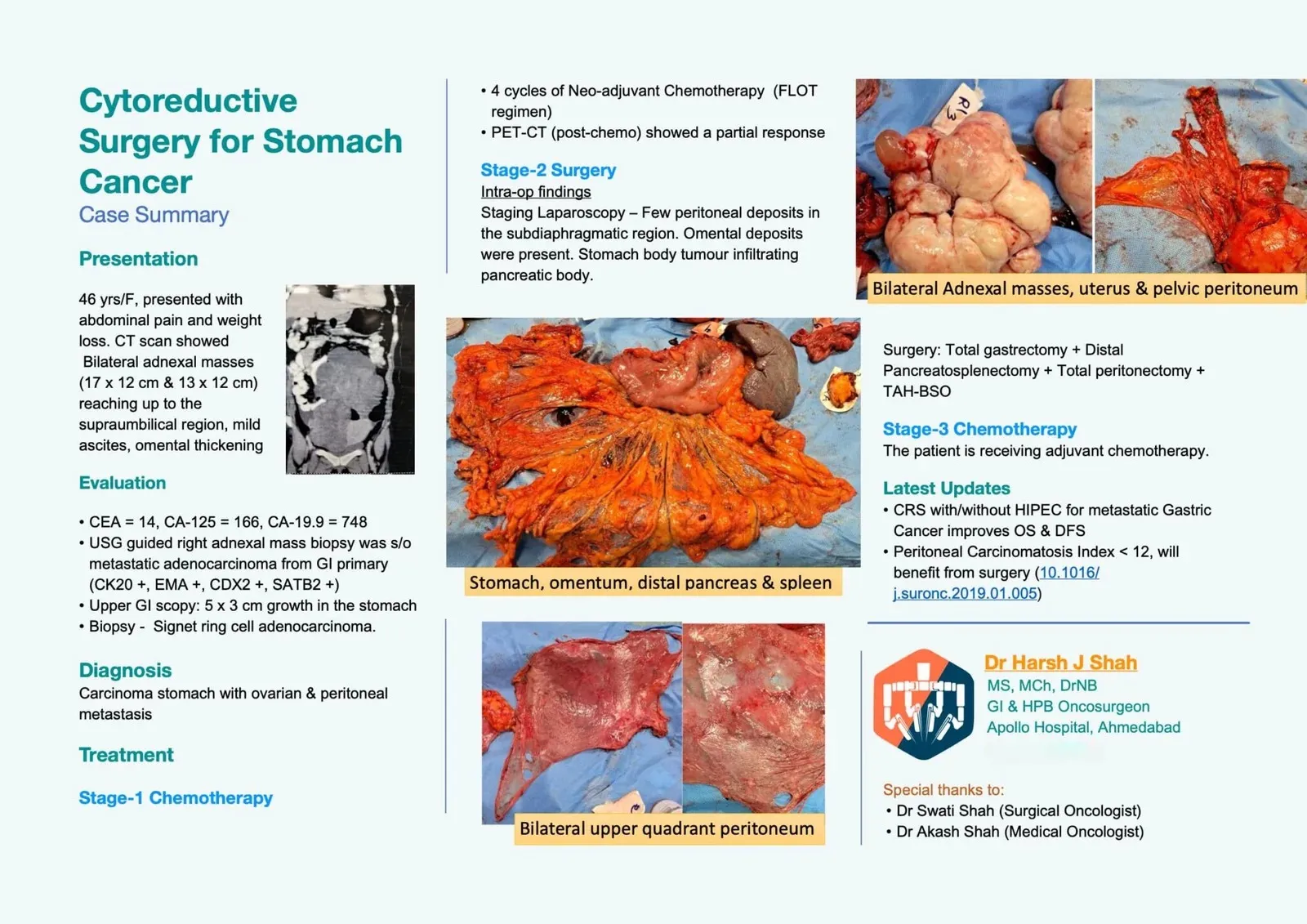 Cytoreductive-Surgery-for-Stomach-Cancer-Case-Summary