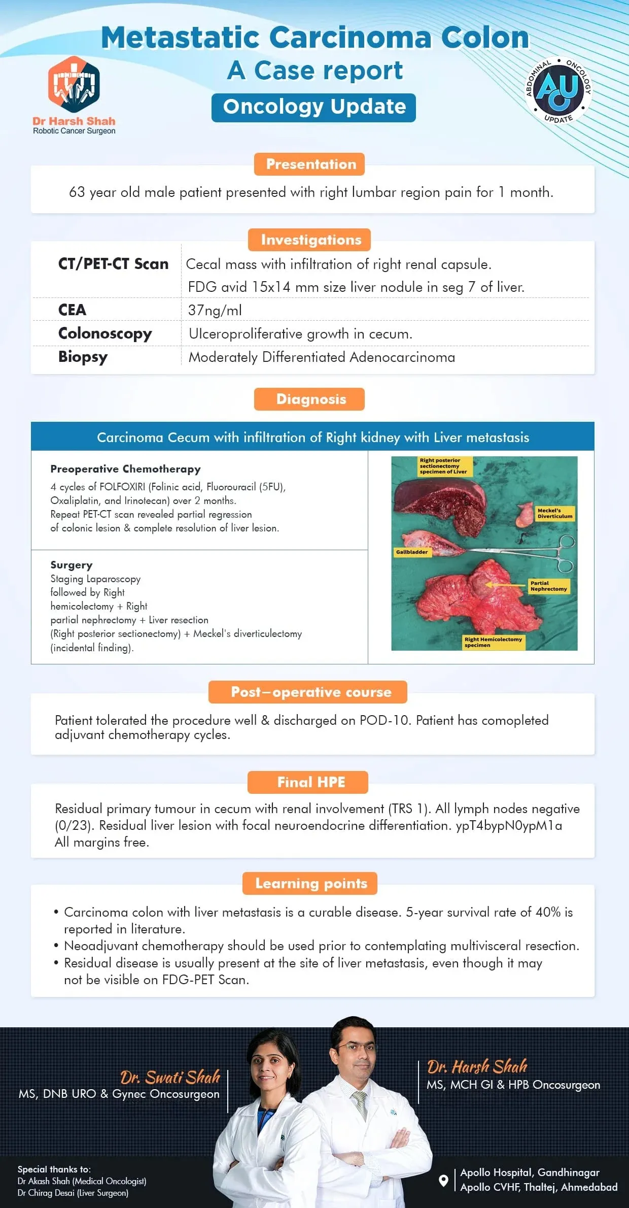 Metastatic-Carcinoma-colon-A-case-report By Dr Harsh & Swati Shah