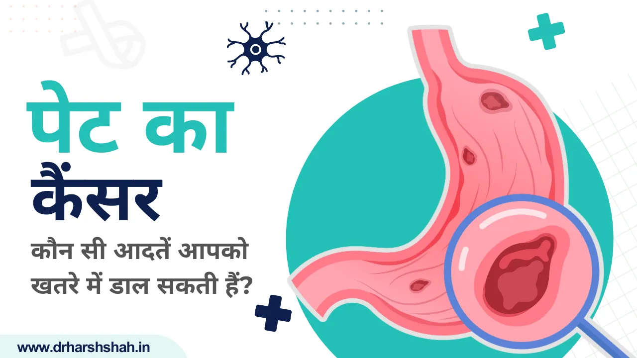 पेट का कैंसर: कौन सी आदतें आपको खतरे में डाल सकती हैं?