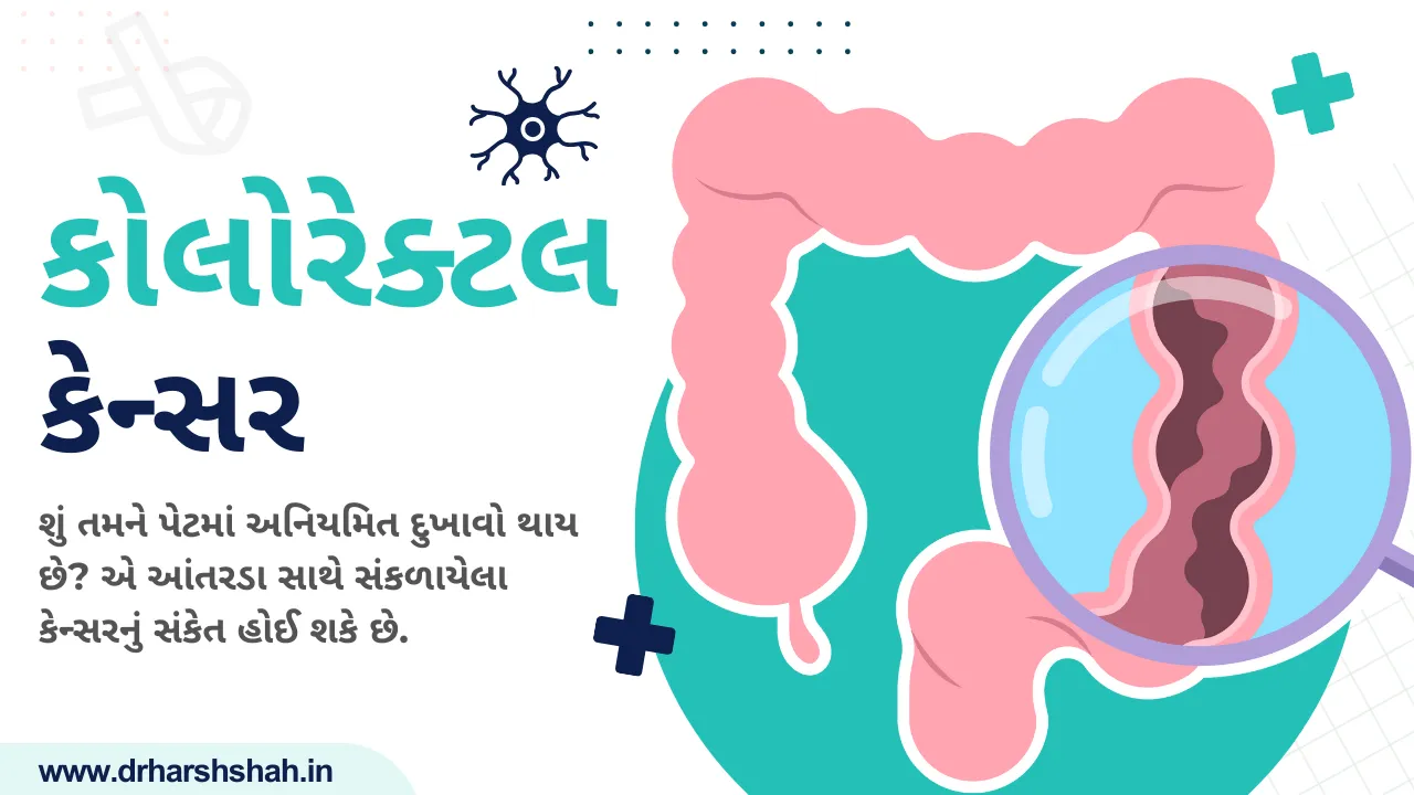 કોલોરેક્ટલ કેન્સર