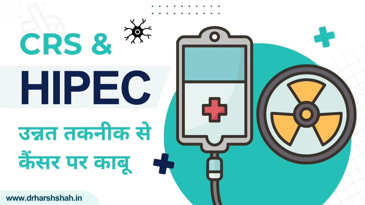 CRS और HIPEC सर्जरी