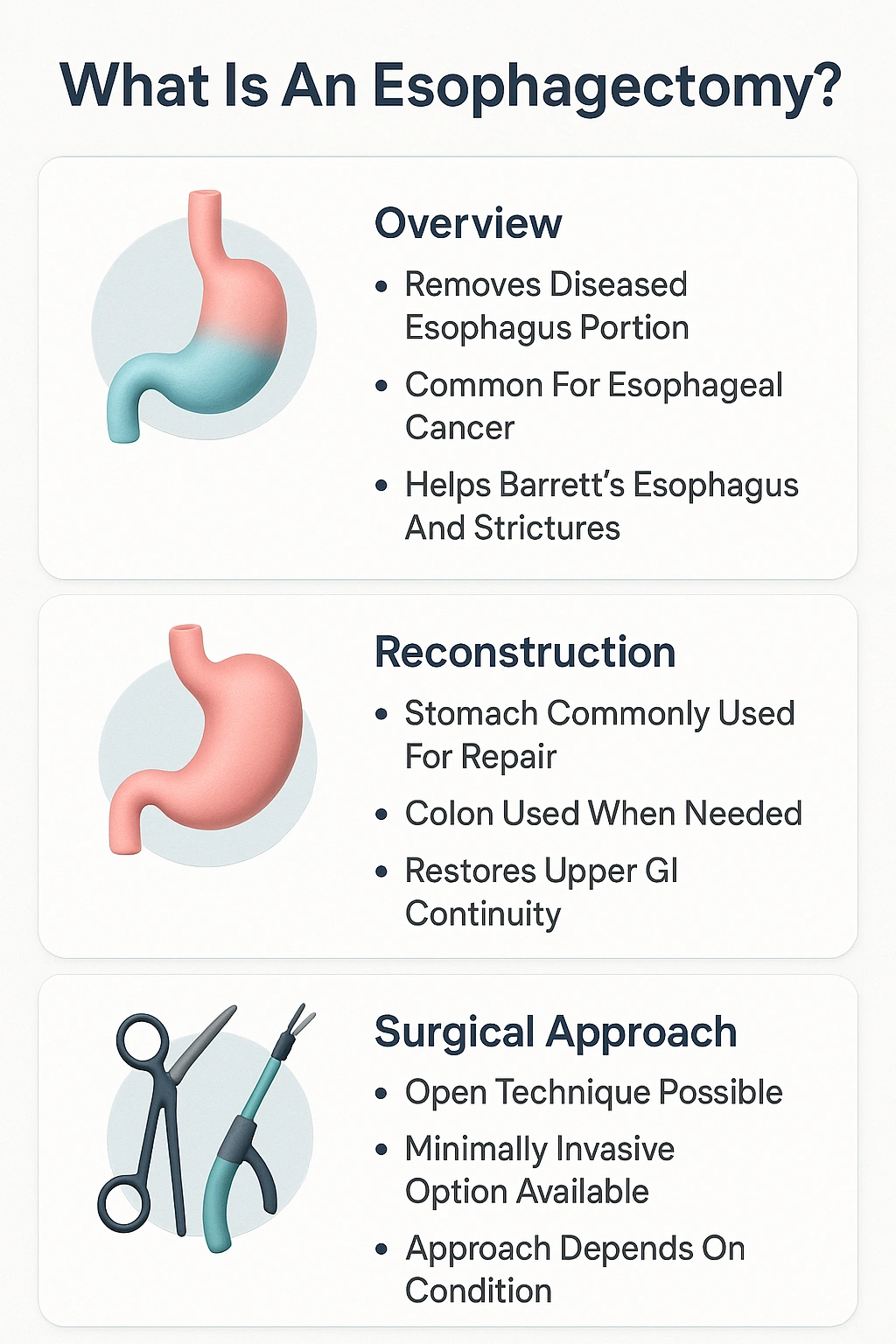 What Is An Esophagectomy