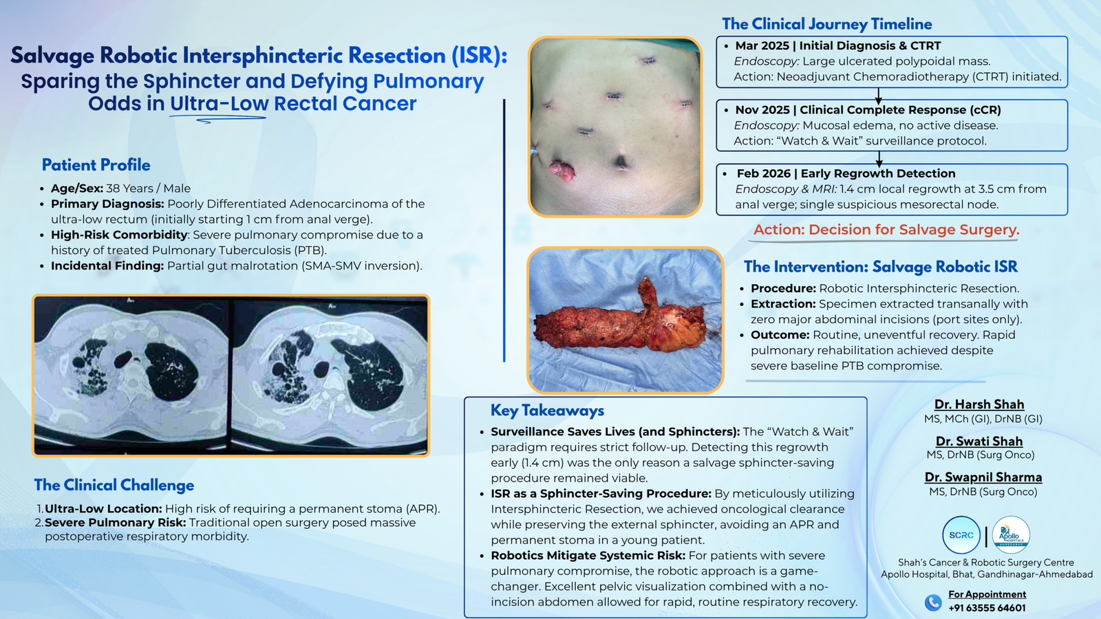 Salvage Robotic Intersphincteric Resection ISR scaled 1