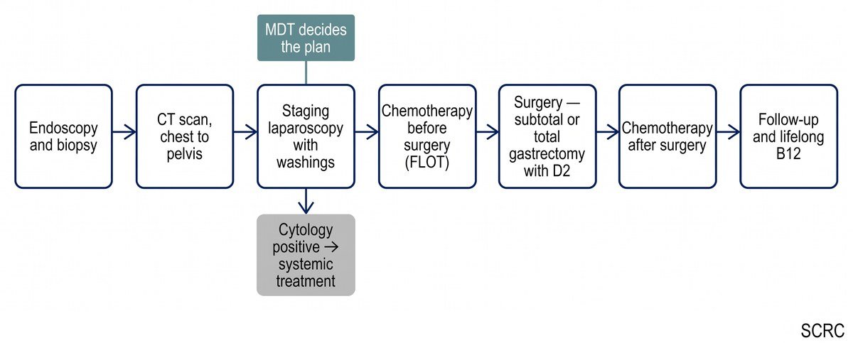 Flowchart of stomach cancer treatment: endoscopy and biopsy, CT scan of chest to pelvis, staging laparoscopy with washings where the MDT decides the plan, chemotherapy before surgery, subtotal or total gastrectomy with D2, chemotherapy after surgery, then follow-up and lifelong B12.